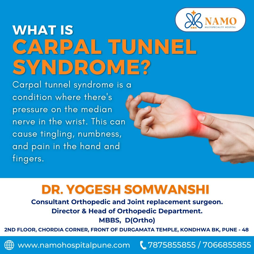 What is Carpal Tunnel Syndrome?